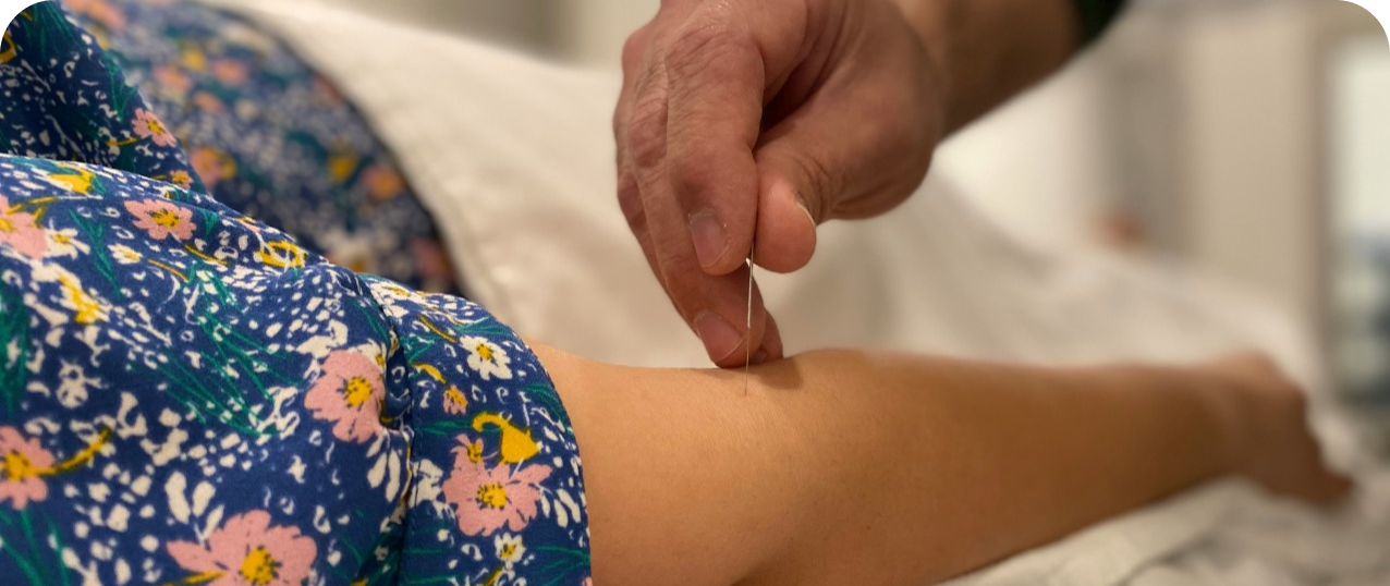 Acupuncture